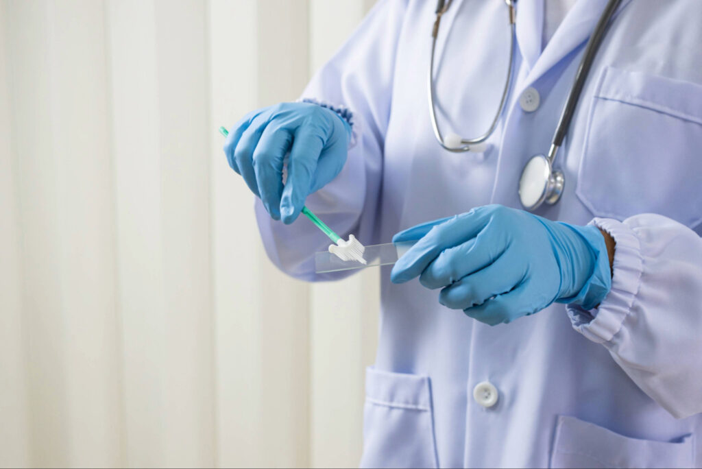 Sample for the free Pap Test and HPV-DNA through the PROLAMVANO program.