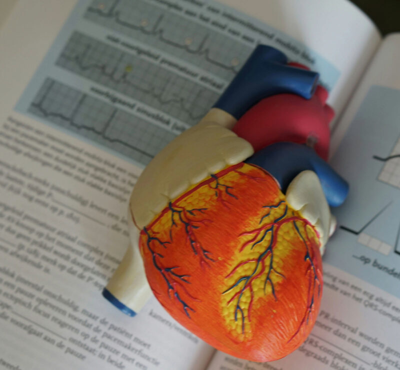 cardio_oncology